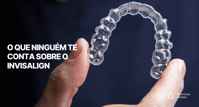 Alinhador transparente sendo segurado pelas mãos, ilustrando o que ninguém te conta sobre o Invisalign e detalhes do tratamento ortodôntico invisível.