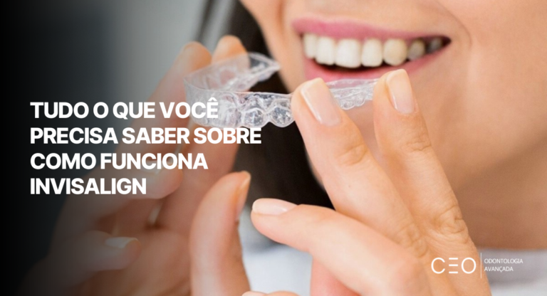 Pessoa segurando alinhador transparente Invisalign próximo ao sorriso, demonstrando como o tratamento ortodôntico funciona.