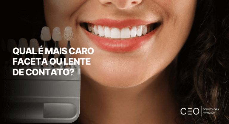 Capa do artigo sobre custo de faceta e lente de contato dental com sorriso e escala de cores para procedimentos estéticos.