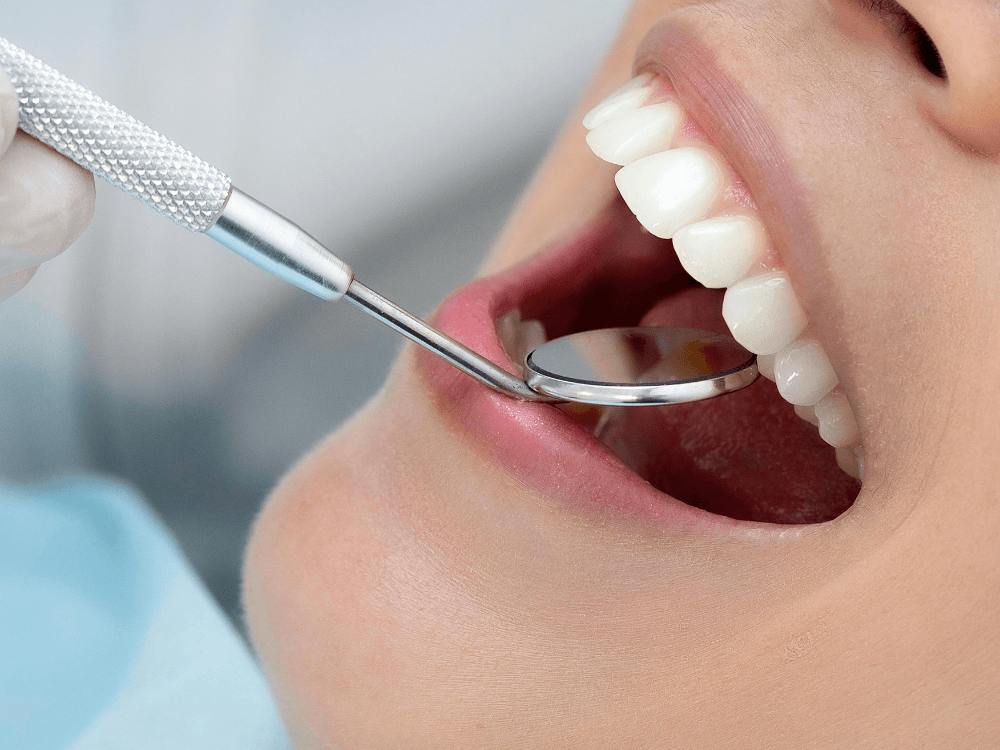 Dentista examina os dentes de uma paciente com espelho clínico durante avaliação para tratamentos estéticos dentários.