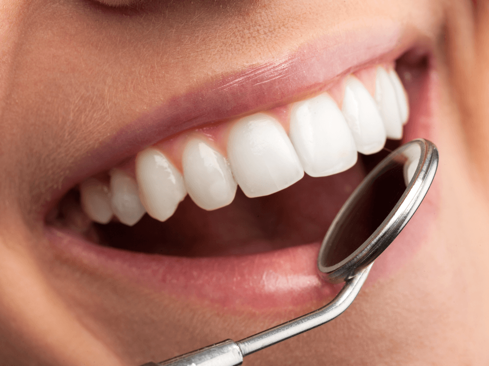 Close de dentes alinhados e claros com espelho odontológico, destacando o resultado estético obtido com tratamentos dentários.