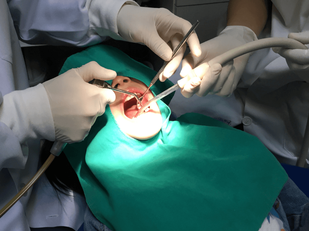 Cirurgia odontológica com profissionais utilizando instrumentos para realizar um procedimento de enxerto ósseo para implante dentário. Tudo para explicar como é feito o enxerto ósseo para implante dentário.
