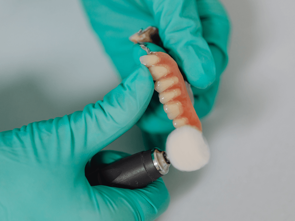 Mãos com luvas verdes seguram uma prótese dentária com dentes artificiais durante um procedimento em ambiente clínico.